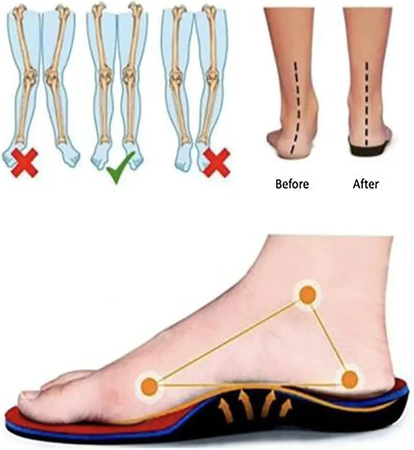 Zapatillas ortopédicas para mujer, zapatillas de malla de plataforma elástica, zapatillas cómodas de moda casual para caminar (n